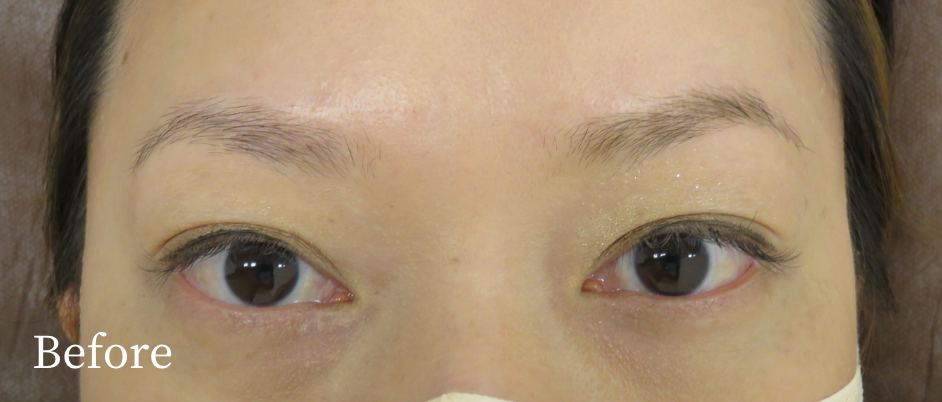 眉アートメイク_パウダーグラデーション_ビフォー