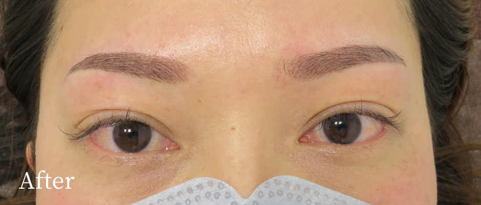 眉アートメイク_パウダーグラデーション_アフター
