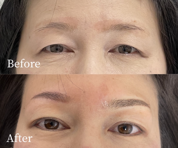 眉アートメイク（コンビネーション）症例写真ビフォー・アフター