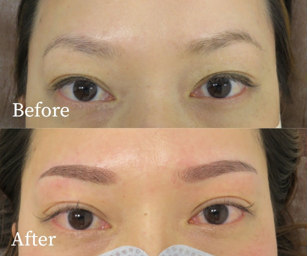 眉アートメイク（パウダーグラデーション）症例写真ビフォー・アフター