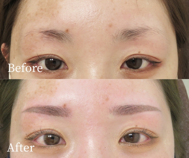 眉アートメイク（パウダーグラデーション）症例写真ビフォー・アフター