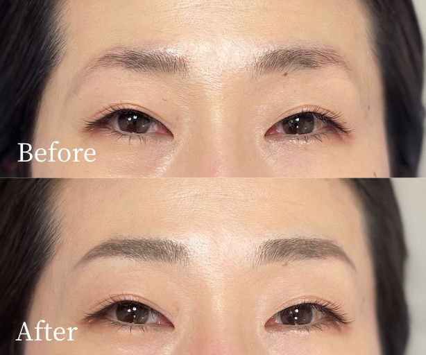 眉アートメイク（パウダーグラデーション）症例写真ビフォー・アフター
