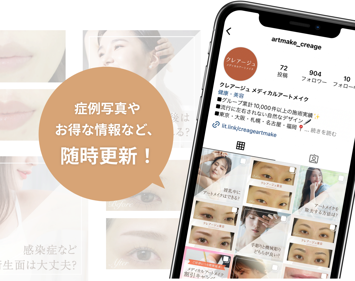 症例写真やお得な情報など、随時更新！