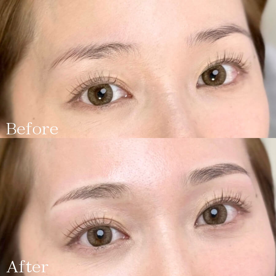 パウダーグラデーションアートメイク症例画像(ビフォーアフター)