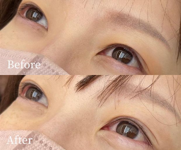 アイライン上アートメイク症例画像(ビフォーアフター)