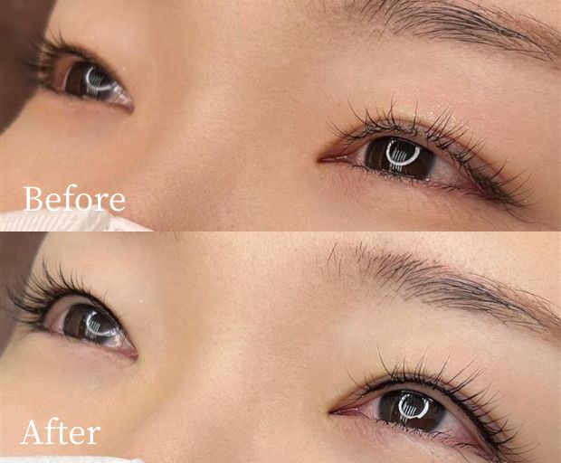 アイライン上アートメイク症例画像(ビフォーアフター)