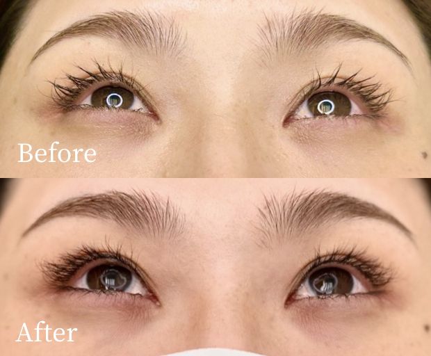 アイライン上アートメイク症例画像(ビフォーアフター)