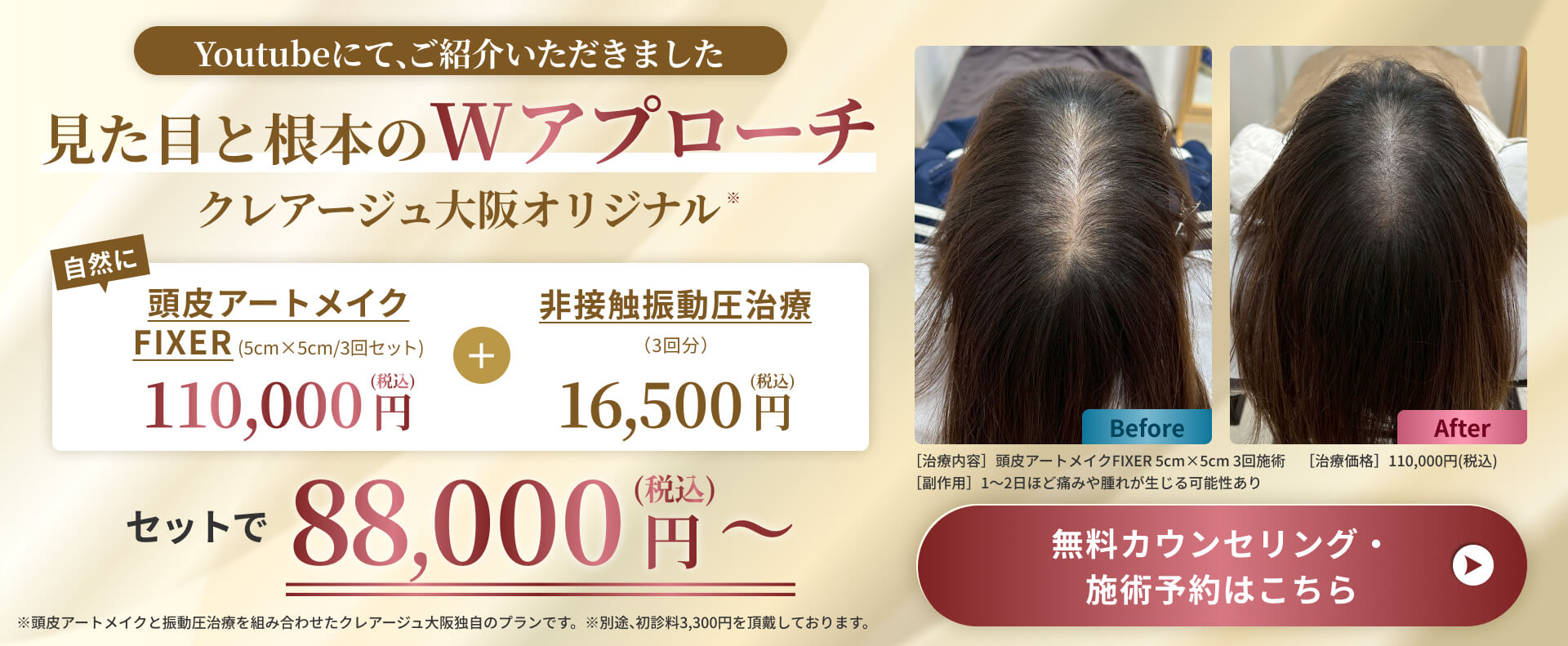 ヘアタトゥー頭皮アートメイク FIXER｜女性の薄毛治療ならクレアージュ