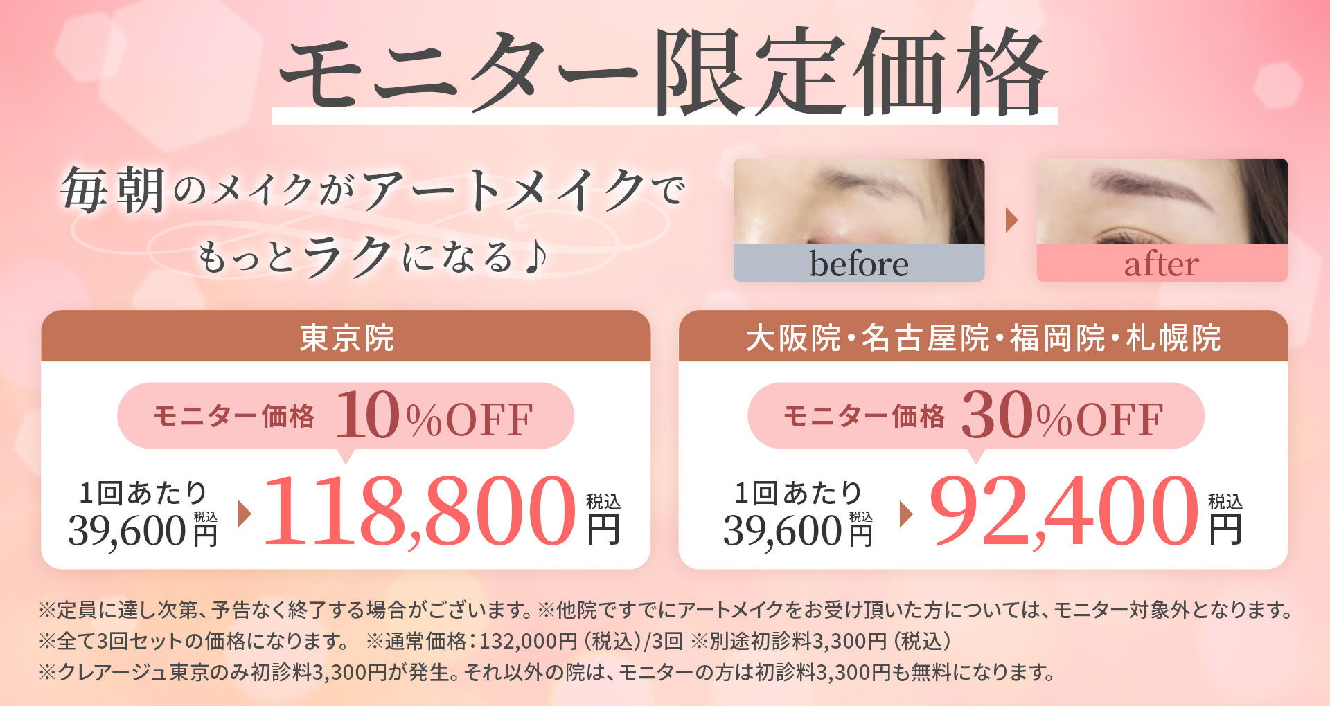 モニター限定価格 毎朝のメイクがアートメイクでもっとラクになる♪ 東京院 モニター価格10%OFF 1回あたり39,600円（税込）→118,800円（税込） 大阪院・名古屋院・福岡院・札幌院 モニター価格30%OFF 1回あたり39,600円（税込）→92,400円（税込） ※定員に達し次第、予告なく終了する場合がございます。※他院ですでにアートメイクをお受け頂いた方については、モニター対象外となります。※全て3回セットの価格になります。※通常価格：132,000円（税込）/3回※別途初診料3,300円（税込）※クレアージュ東京のみ初診料3,300円が発生。それ以外の院は、モニターの方は初診料3,300円も無料になります。